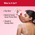 Bye Acne, welcome Freshness! (Acne Body Wash - 236 ml | Aqua Underarm Roll On - 40 ml)