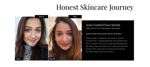 Skin Care Journey
