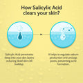 2% Salicylic Acid Face Serum for Acne Control - 30 ml