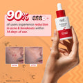 2% Salicylic Acid Face Serum With Lactic Acid | For Acne Control - 30 ml