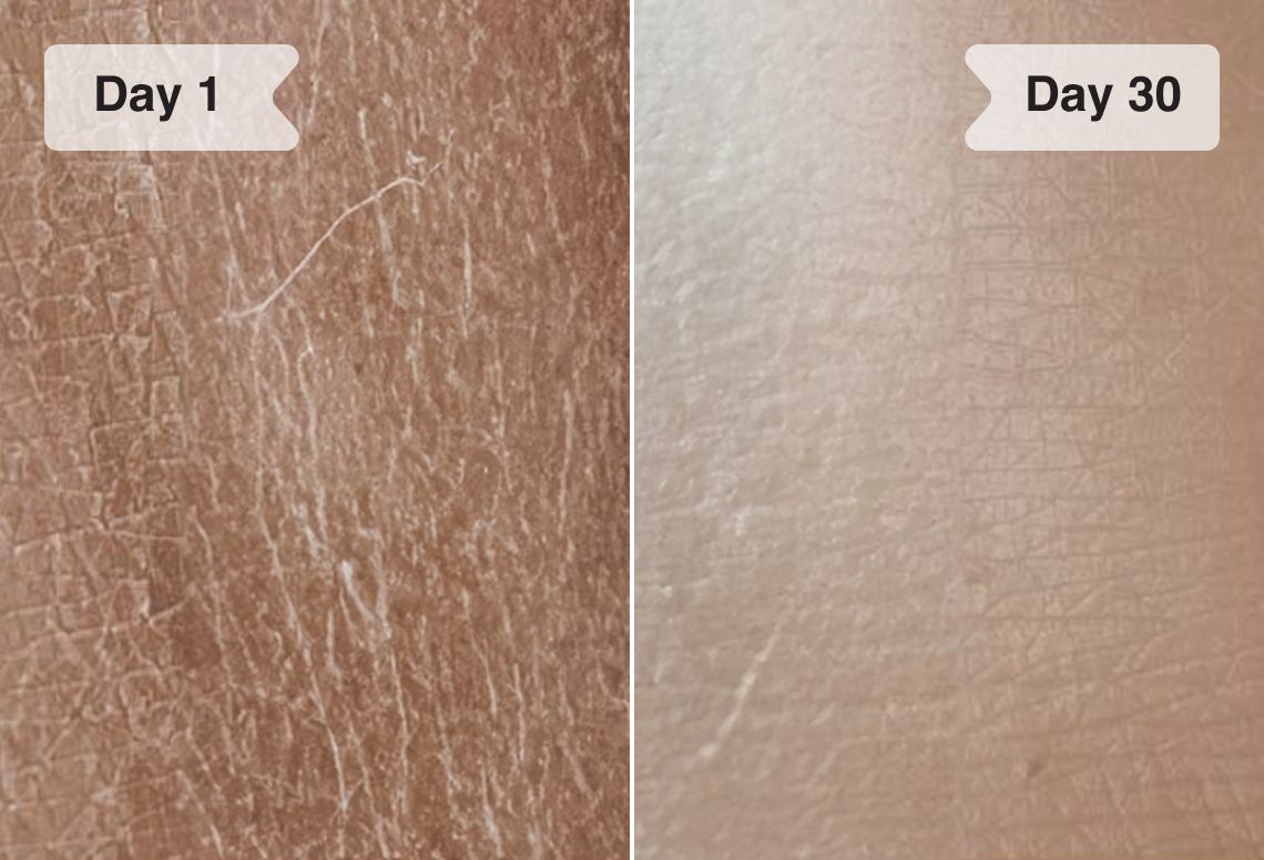 Results before/after