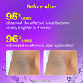 Neck Knee Roll On (40 ml) + Underarm Roll On Fragrance Free (40 ml)