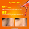 26% AHA + 4% PHA + 2% BHA Exfoliating Peeling Solution - 30 ml