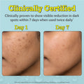10% Vitamin C Serum for Glowing & Bright Skin - 30 ml