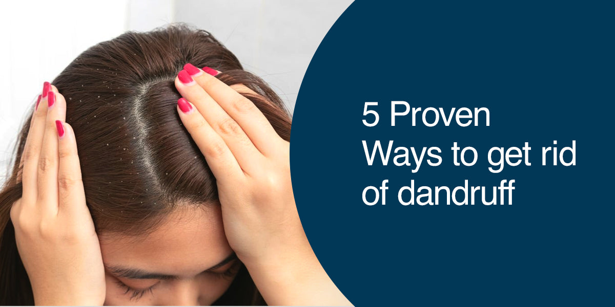 How to Get Rid of Dandruff From Hair?