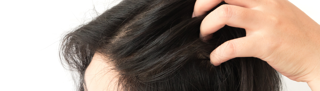 How to Fix an Oily Scalp Without Drying Out Your Hair?