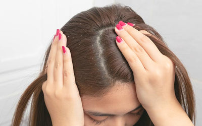 The Causes of Dandruff: Understanding the Condition and Its Triggers