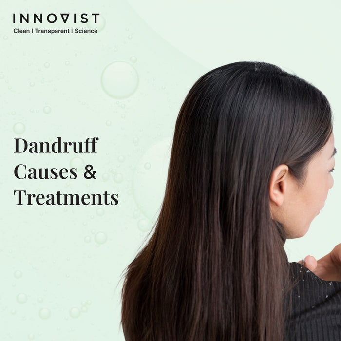 A Complete Guide to Dandruff Causes, Symptoms & Treatments