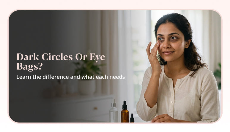 Difference between dark circles vs under-eye bags