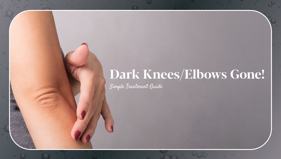 Dark Knees & Elbows