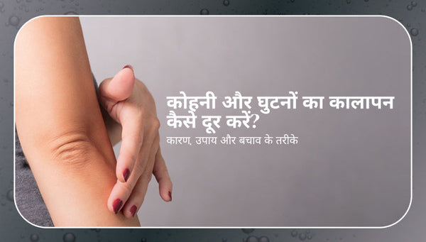 कोहनी और घुटनों का कालापन कैसे दूर करें