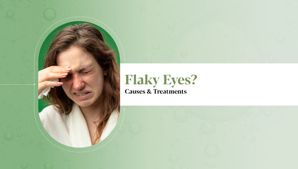 Flaky Eyes Causes