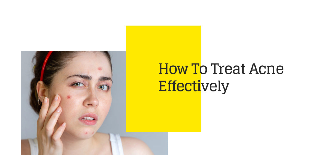 How To Treat Acne Effectively – Innovist