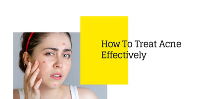 How To Treat Acne Effectively