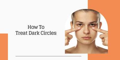 How To Treat Dark Circles Under The Eyes