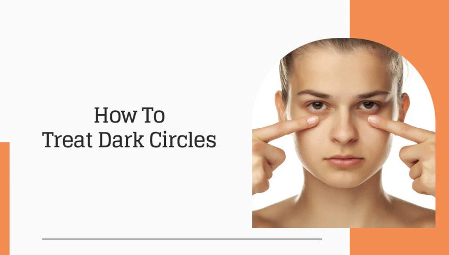 How To Treat Dark Circles Under The Eyes