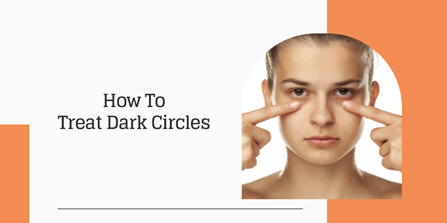 How To Treat Dark Circles