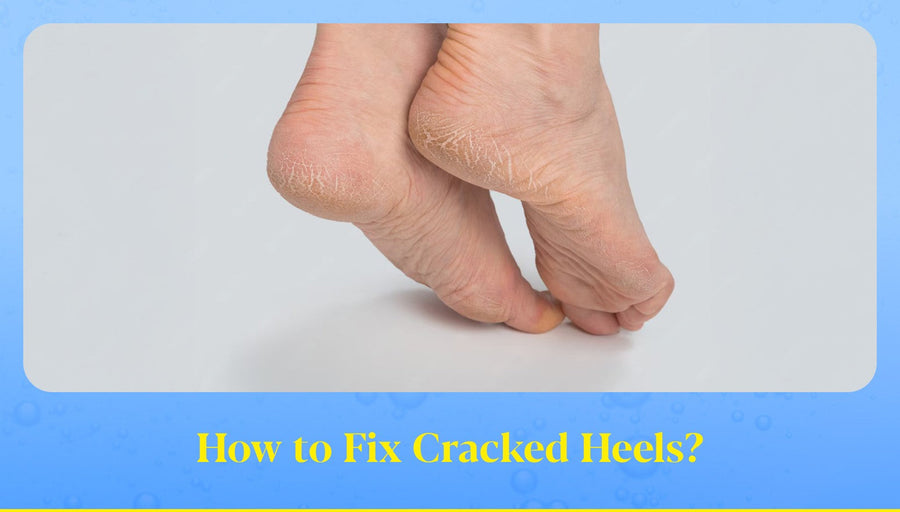 how to fix cracked heels