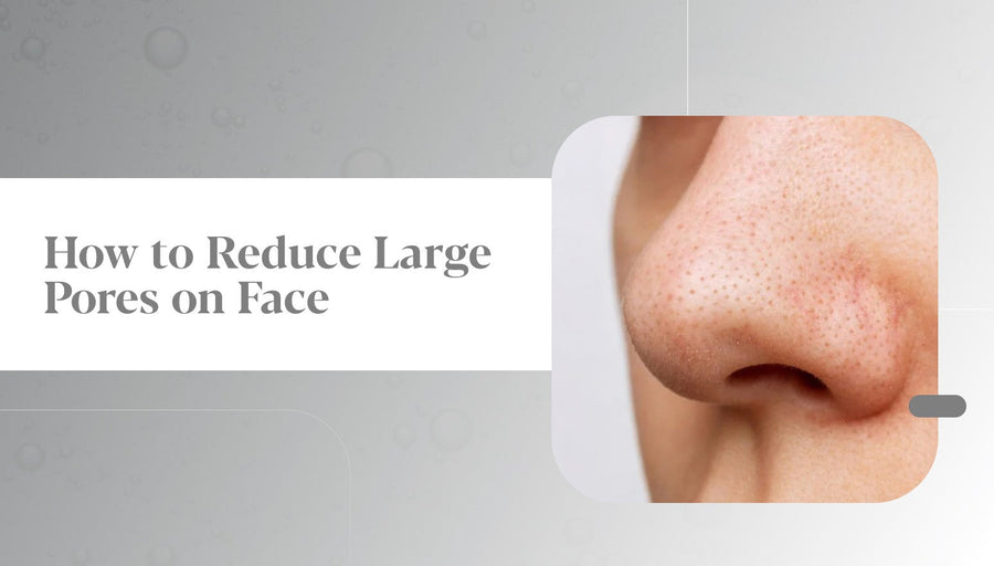 reduce pores on face