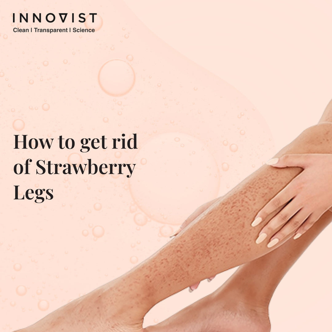 Strawberry Legs: Causes, Treatments & Tips to Prevent Them