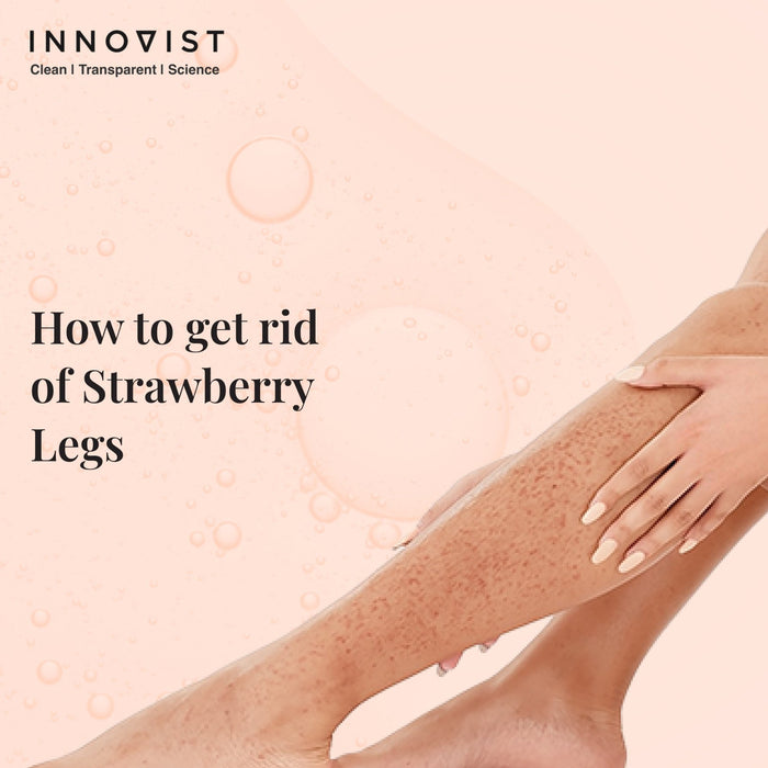 Strawberry Legs: Causes, Treatments & Tips to Prevent Them