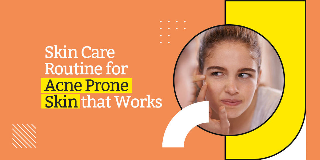 Skin Care Routine for Acne Prone Skin that Works