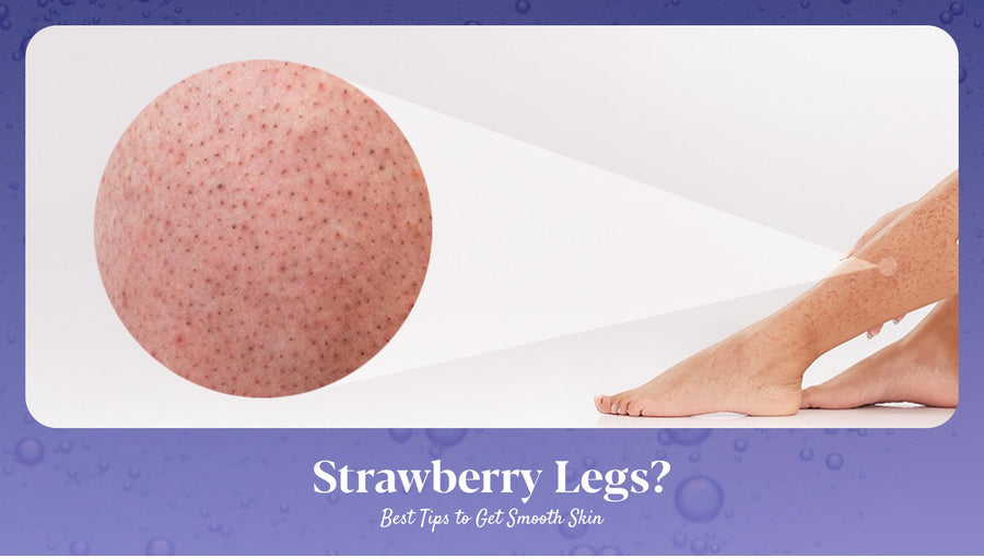 Strawberry legs treatment