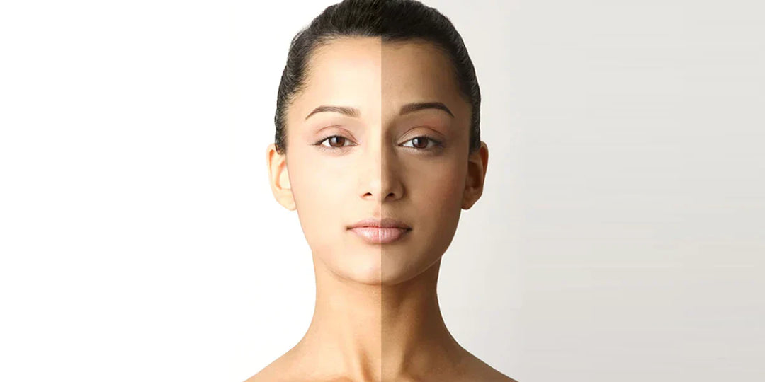 How To Reduce Melanin Production in 3 Months?