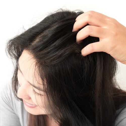 How to Fix an Oily Scalp Without Drying Out Your Hair?