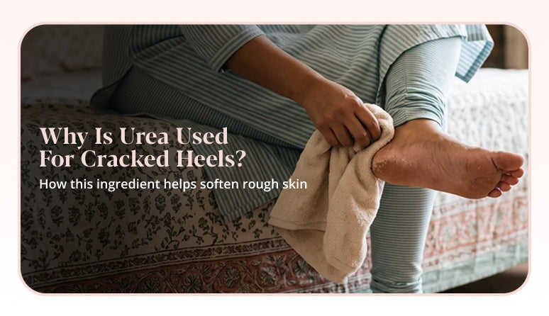 How to use urea for cracked heels