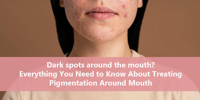 Dark spots around the mouth? Everything You Need to Know About Treating Pigmentation Around Mouth