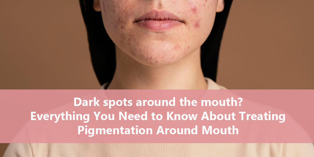 pigmentation around mouth