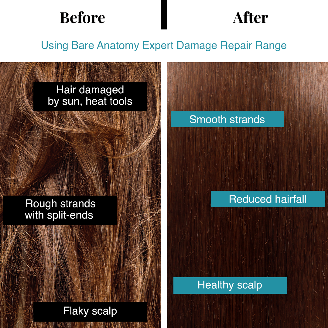 Shampoo for Dry Hair, Scalp, Damage (3x Strength) - Bare Anatomy