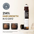 Clear Scalp Growth Pack (Hair Growth Serum Roll On - 25 ml | Anti-Dandruff Shampoo - 250 ml)