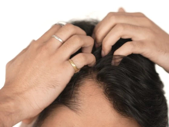 Step 2 image