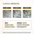 Advanced Hair Growth Serum with 3% Redensyl, 4% Anagain, 3% Bicapil & 1% Capilia Longa - 30 ml