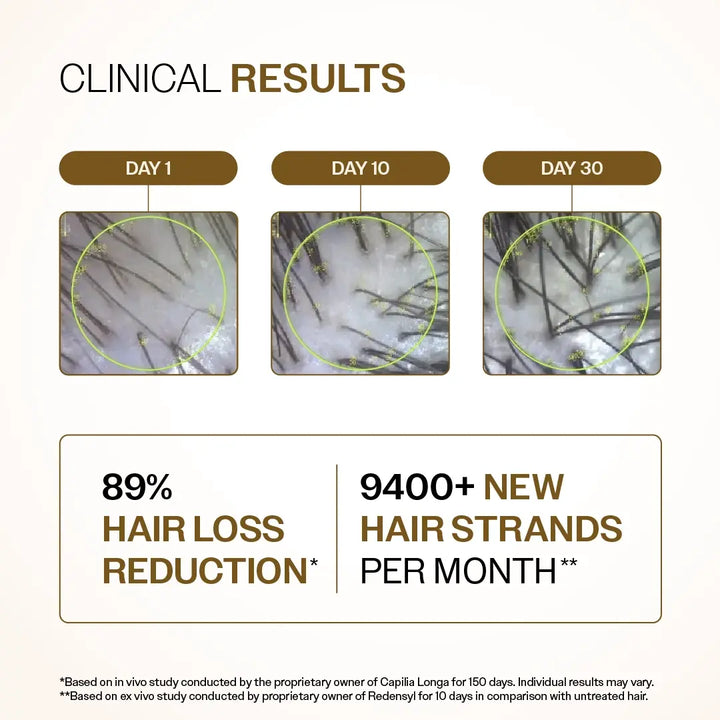 Advanced Hair Growth Serum with 3% Redensyl, 4% Anagain, 3% Bicapil & 1% Capilia Longa - 30 ml