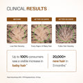 Advanced Hair Growth Serum With 3% Redensyl, 4% Anagain, & 1% Capilia Longa - 30 ml