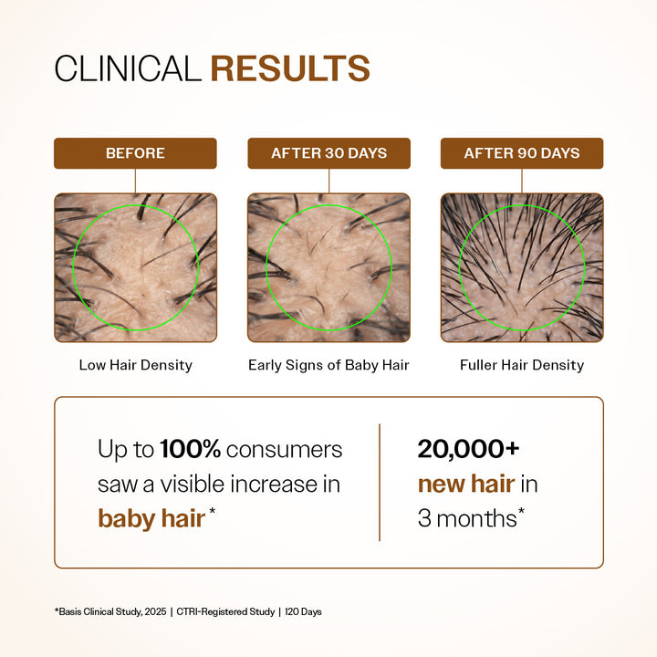 Advanced Hair Growth Serum With 3% Redensyl, 4% Anagain, & 1% Capilia Longa - 30 ml