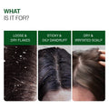 Anti-Dandruff Shampoo (250ml ) & Anti-Dandruff Serum (50 ml) Combo