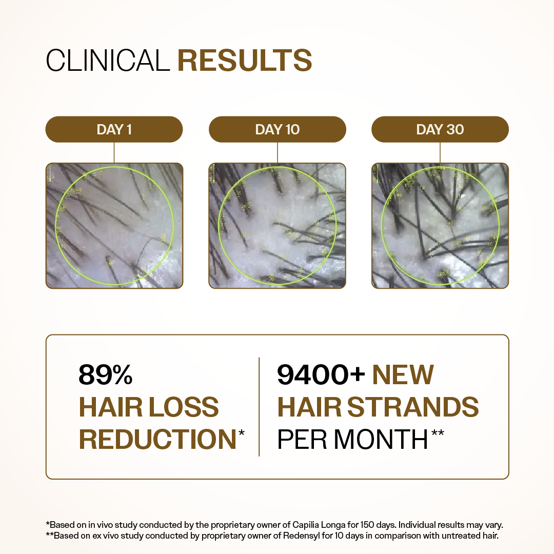 Advanced Hair Growth Serum with 3% Redensyl, 4% Anagain, 3% Bicapil & 1% Capilia Longa - 30 ml