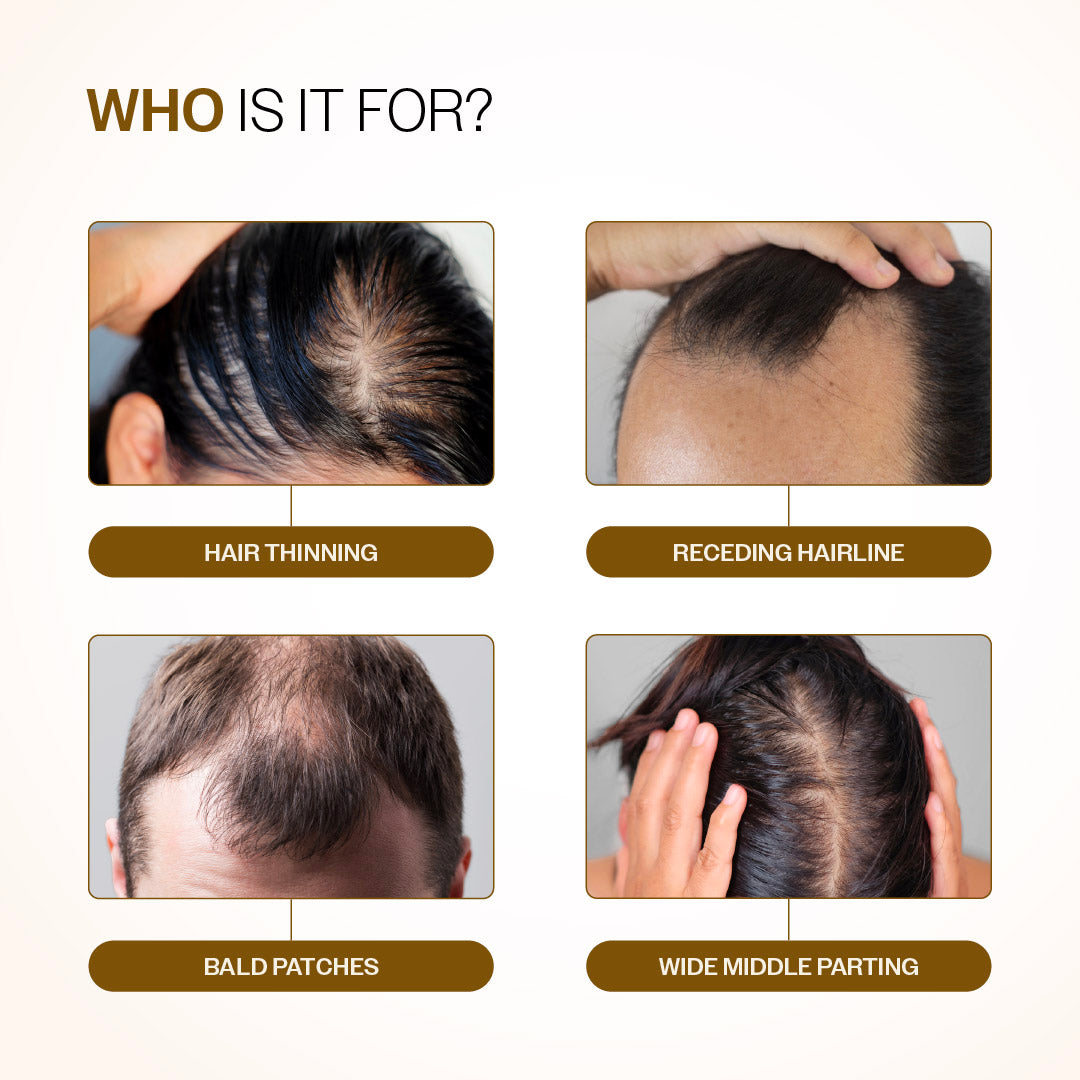 Advanced Hair Growth Serum Roll-On with Redensyl, Rosemary & Rice Water- 25 ml