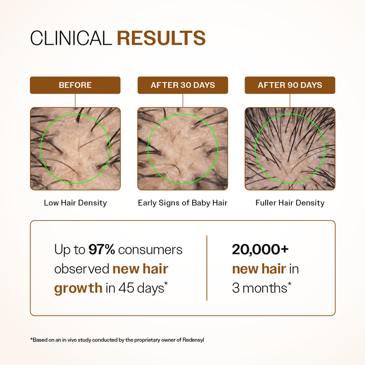 Advanced Hair Growth Serum Spray with 5% Rosemary Extract, 4% Anagain & 3% Redensyl- 30 ml