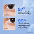 Under Eye Cream with Caffeine & Green Tea - 15 gm