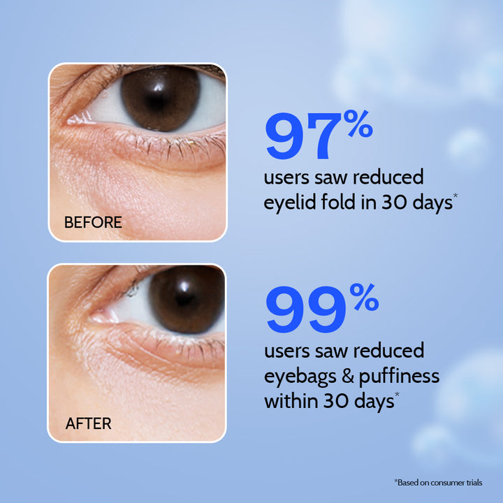 Under Eye Cream for Dark Circles Removal & Wrinkles - 15g