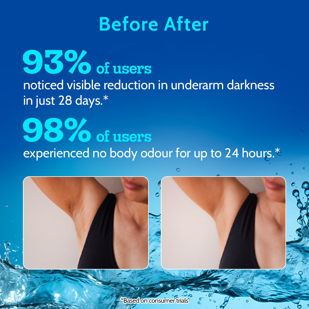 Tri-Active Underarm Roll On for Hair Growth Reduction