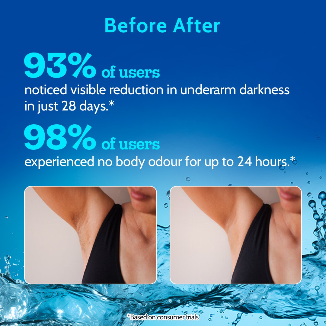 Tri-Active Underarm Roll On for Hair Growth Reduction