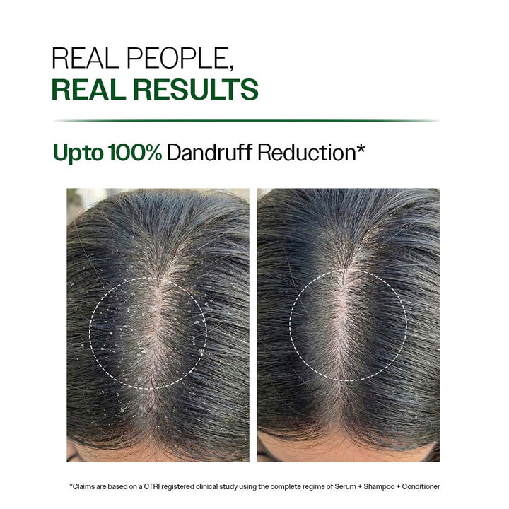 Anti Dandruff Shampoo with Salicylic Acid & Biotin- 750ml