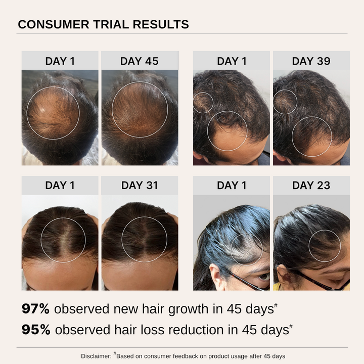 Advanced Hair Growth Serum with Redensyl, Rosemary, Rice Water (20ml)
