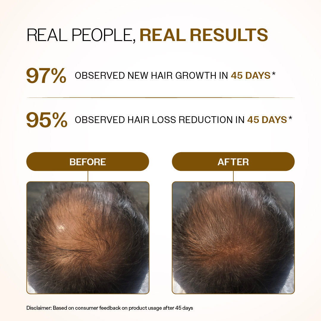 Advanced Hair Growth Serum Roll-On with Redensyl, Rosemary & Rice Water- 25 ml